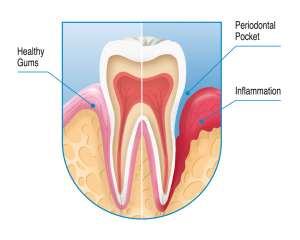 Tooth _PCh.fh9